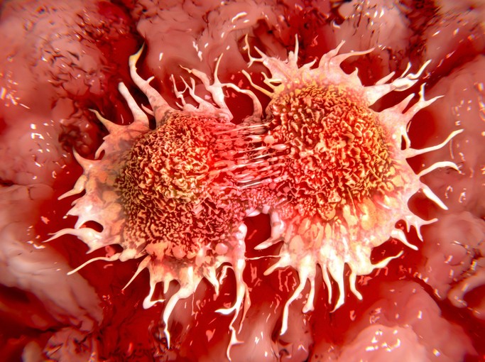 Understanding metastatic cancers