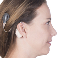 The end of cochlear implants?