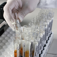 Call for proposals for the biobank of the Canadian Health Measures Survey