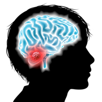 Biology of tumour changes when childhood brain cancer recurs