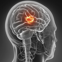 A new treatment target for cancer