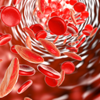 Teenager’s sickle cell reversed with world-first therapy